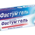 Хруст в суставах причины и лечение — Суставы