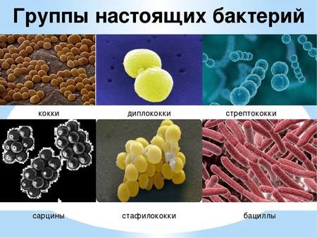 Золотистый стафилококк в горле лечение: пути инфицирования, виды, как лечить