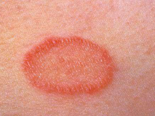 Инструкция по применению мази Преднизолон - показания