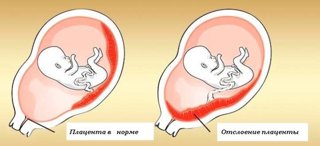 Развитие плода на 8 неделе беременности (17 фото): что происходит с малышом, размеры ребенка и ощущения, как выглядит малыш на 8 акушерской неделе