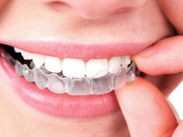 Бруксизм у взрослых: причины и варианты лечения