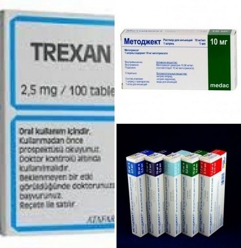 Метотрексат при ревматоидном артрите — Суставы