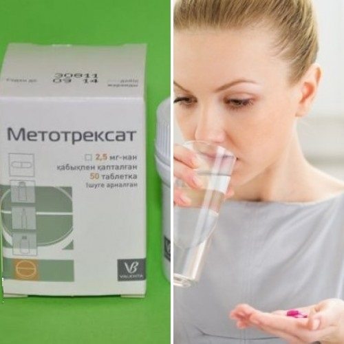 Метотрексат при ревматоидном артрите — Суставы