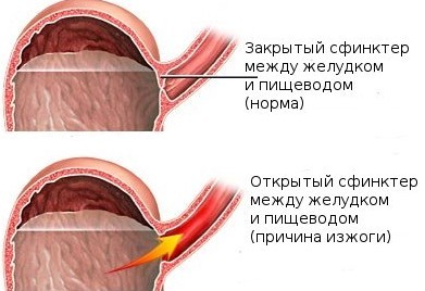 Гастал мята - официальная инструкция по применению, аналоги