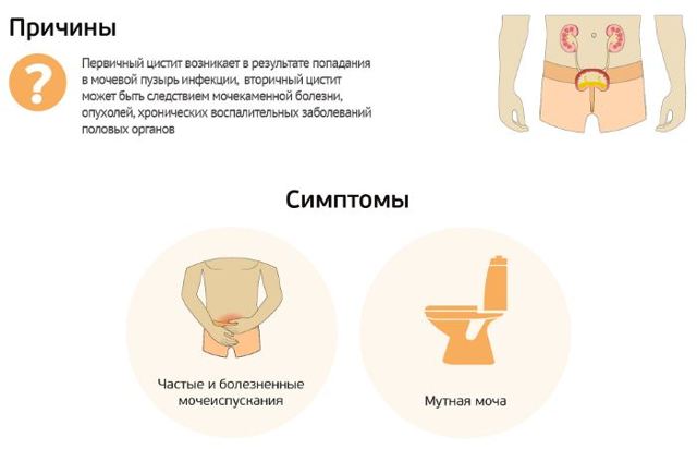 Цистит у мужчин - виды, причины, симптомы и лечение
