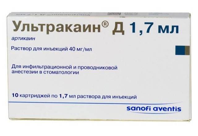 Ультракаин цена в Томске от 5371 руб., купить Ультракаин, отзывы и инструкция по применению