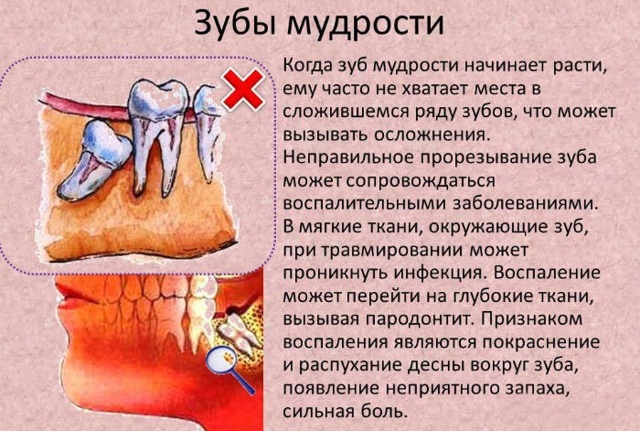 Воспаление десен — Топ-10 причин, симптомы, признаки и что делать при заболевании