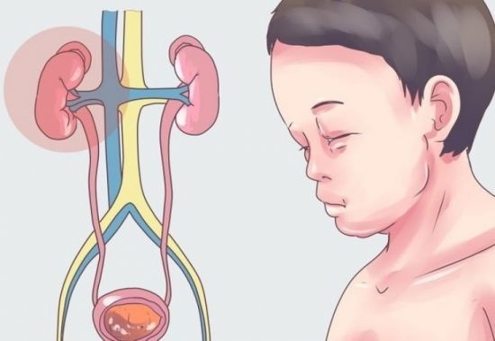 Отек ног в области стопы: причины припухлости правой и левой ступни, что делать, почему отекают ноги у женщин