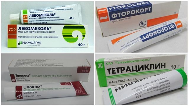 Укус осы (опухоль и покраснение): что делать - Воспитание с Умом