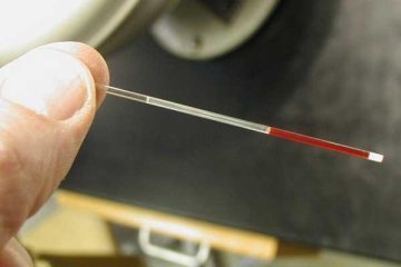Гематокрит повышен у взрослого, о чем это говорит? 10472 2