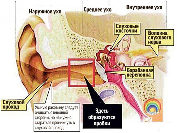 Серная пробка в ухе – лечение и удаление в домашних условиях (как почистить и пробить) 2019