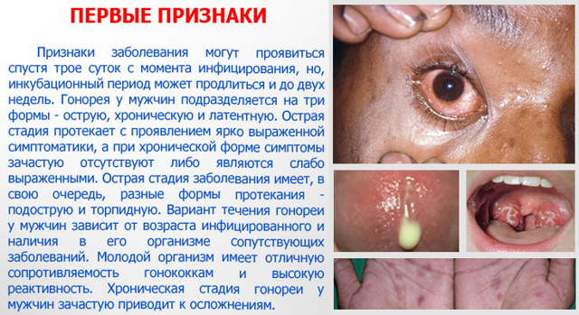 Гонорея у мужчин и женщин: симптомы, диагностика, лечение