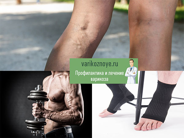 Как лечить варикоз на ногах у женщин и у мужчин и чем он опасен?