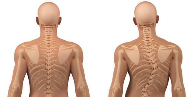 Отек ног в области стопы: причины припухлости правой и левой ступни, что делать, почему отекают ноги у женщин