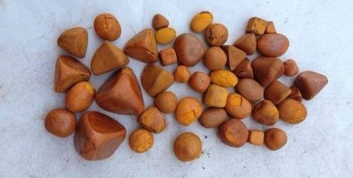 Камни в желчном пузыре: симптомы и лечение без операции